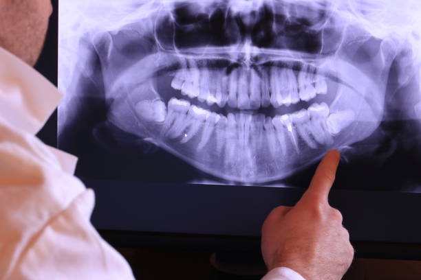 Best Cracked Tooth Emergency Dentist  in Everett, PA